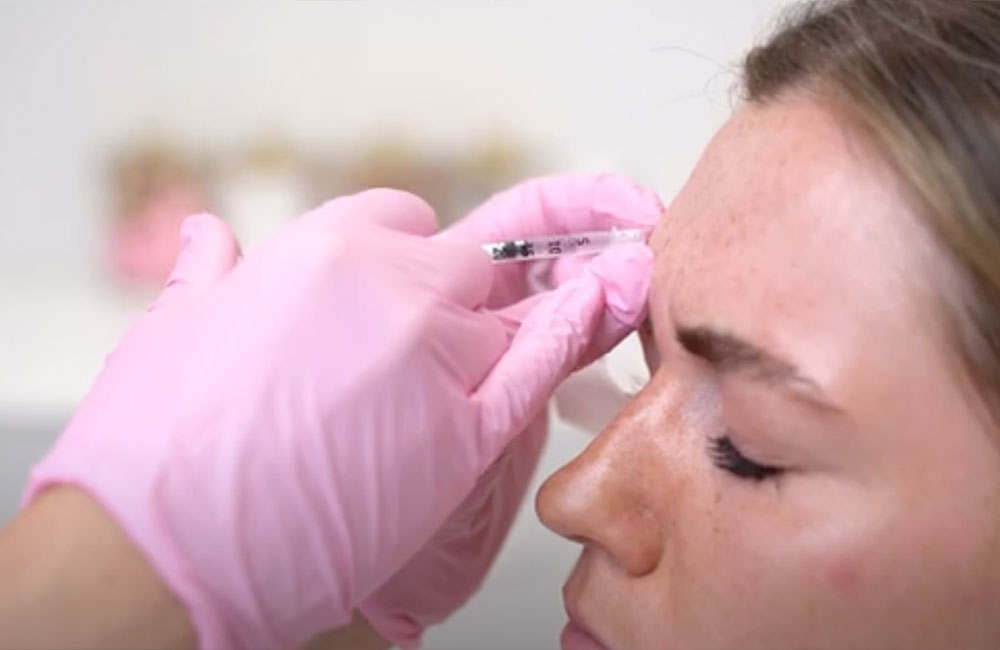 patient receiving dysport in Ashburn & Leesburg