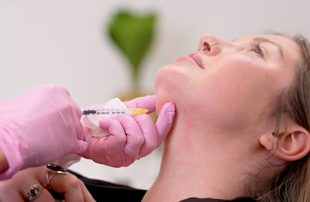 woman getting kybella in ashburn & leesburg