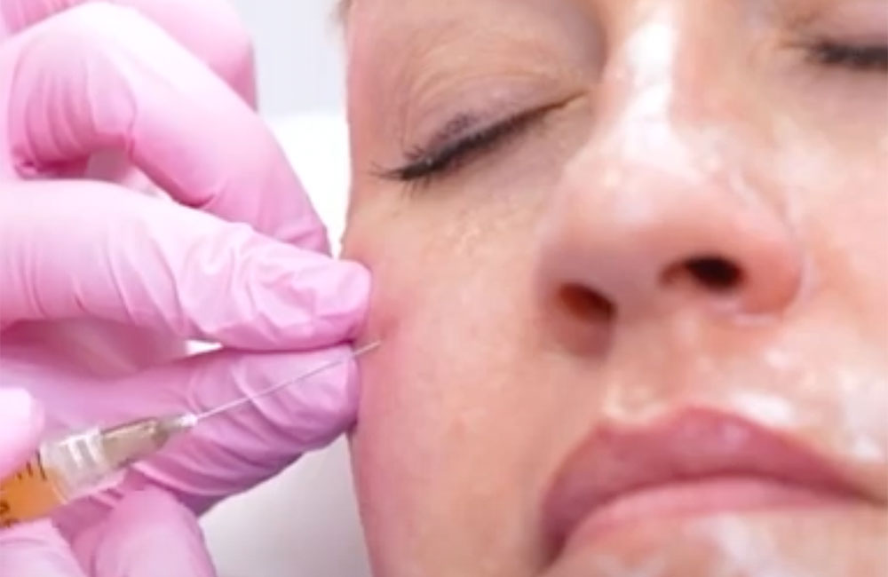 woman getting eye rejuvenation in Ashburn & Leesurg